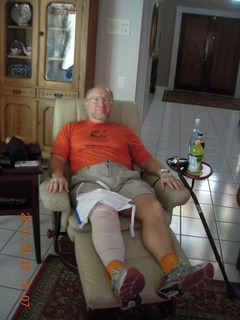 my knee after a bike fall