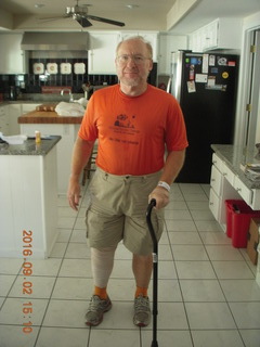 after knee operation