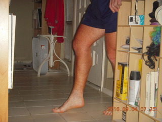 two days after my knee surgery