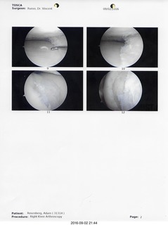 knee surgery images