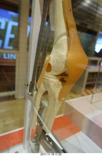 two days after my knee surgery