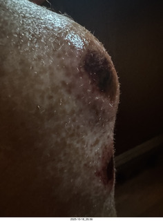 Philadelphia - The Franklin Institute - artificial knee